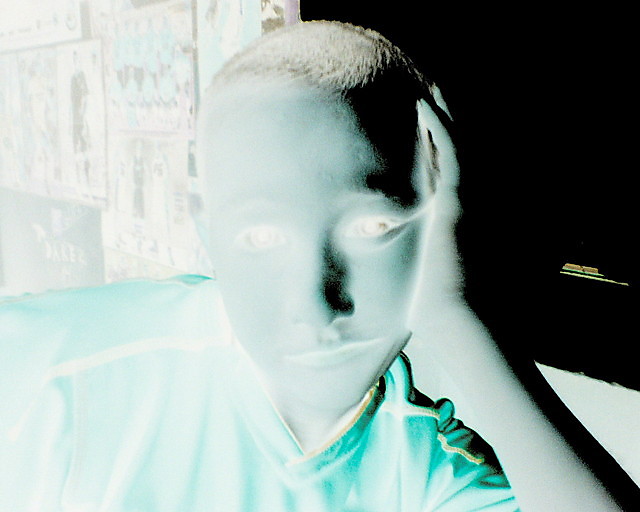 Poraony soncem   xD