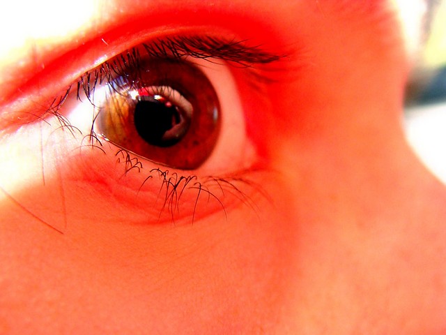 ocko.