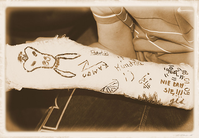 Gips