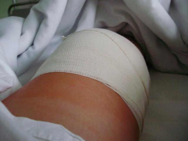 kolanoooo. ;|