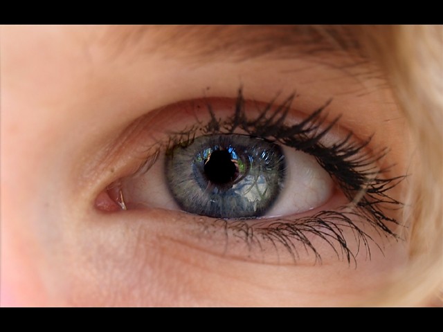 eye