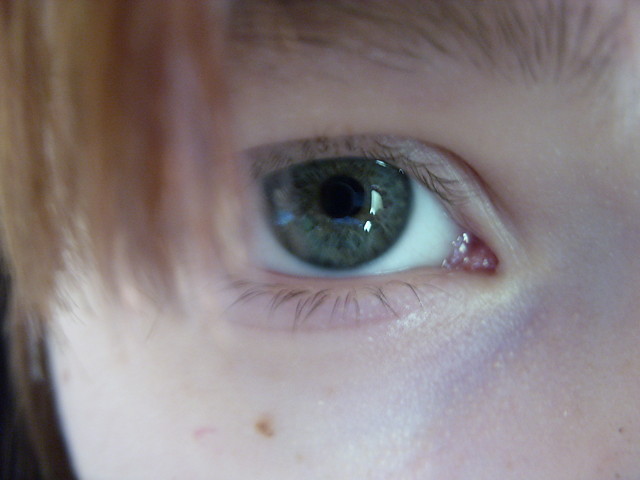 My eye xD