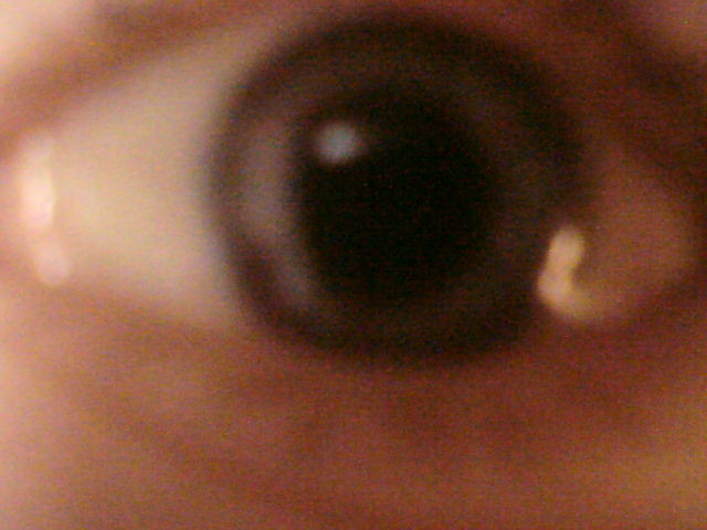 My eye XD