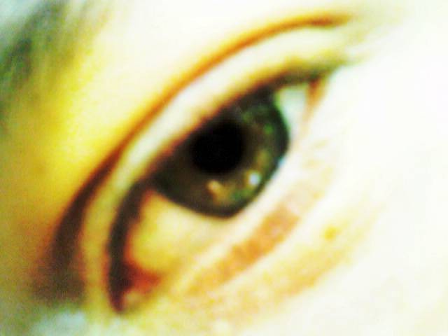 My Eye