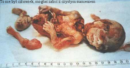 Eutonazja.