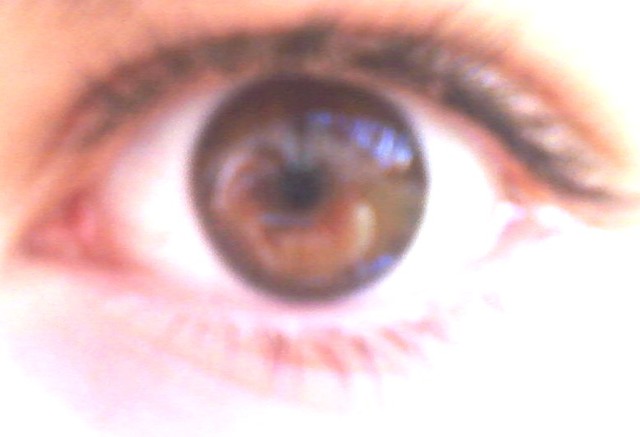 My eye :D