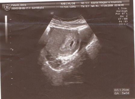 17.09.2009