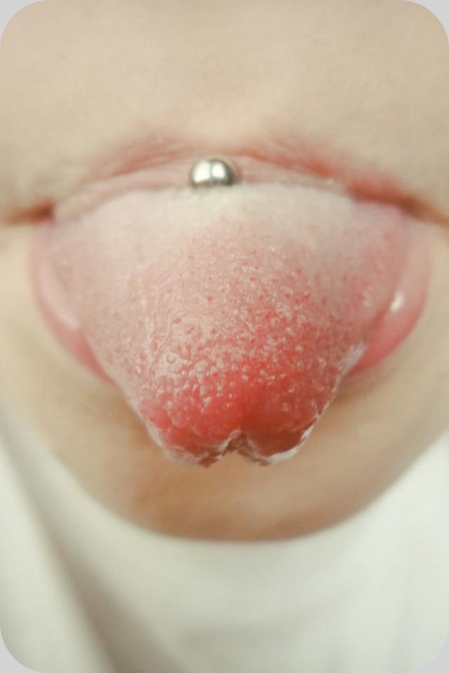 58