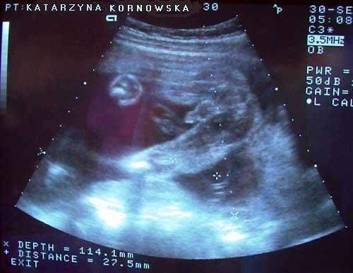 Nasze Dziecko ;D