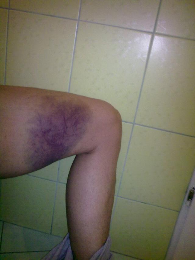Wpis remas666