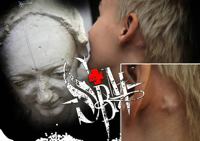 Silicone implant by Sala