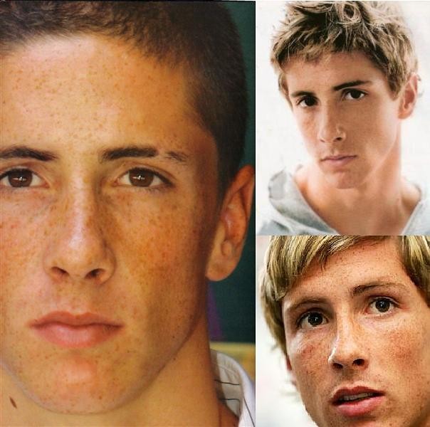 Torres ^^