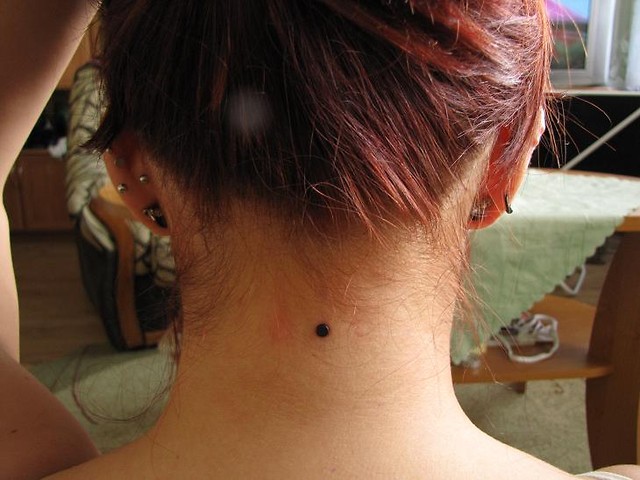 dermal