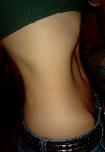 Wpis mybodyisacage