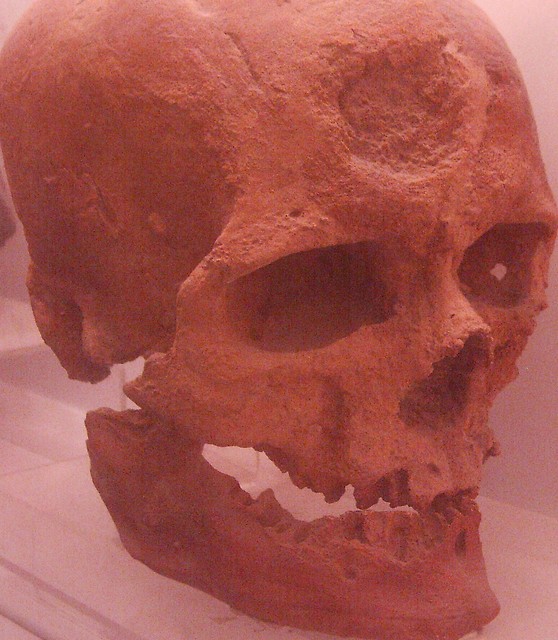 skull : D