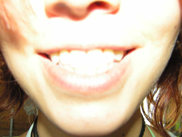 mimo matury itd.