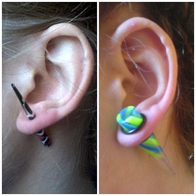 Before - TODAY