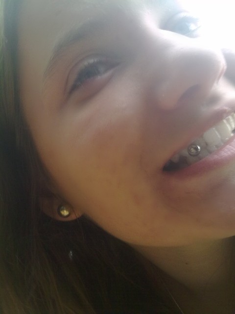 Wpis hoooope