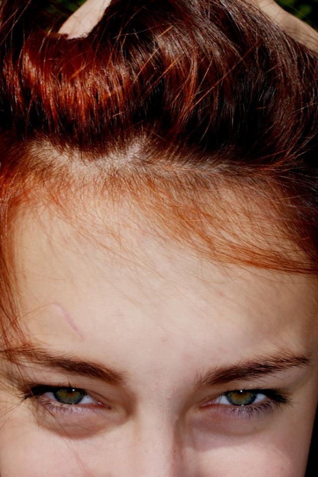 eyes on fire