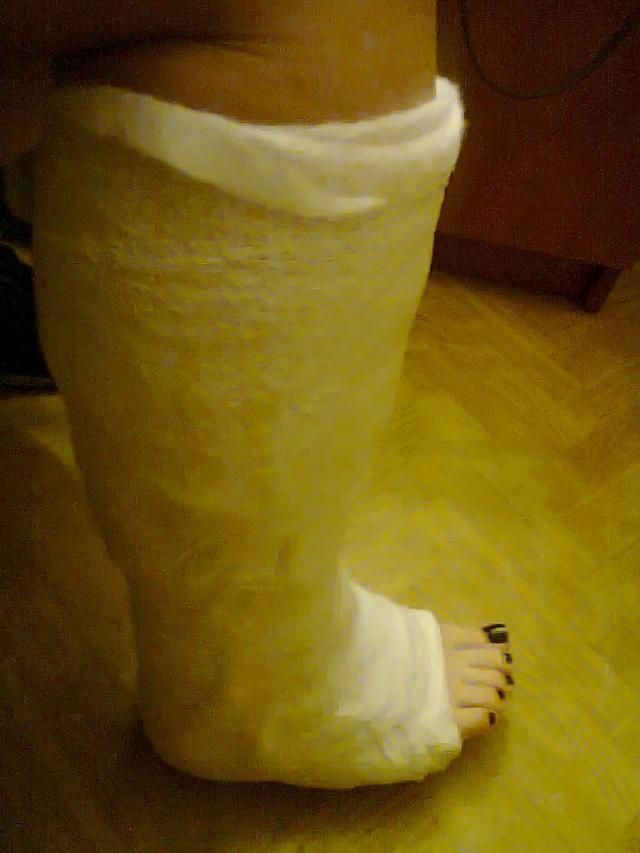 Gips ;/