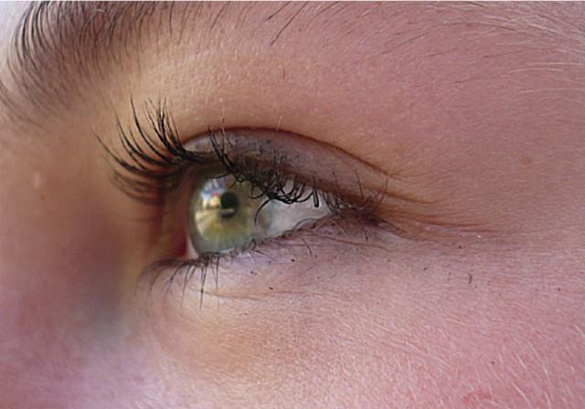 My eye 