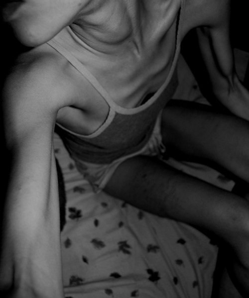 Wpis eatingdisorders