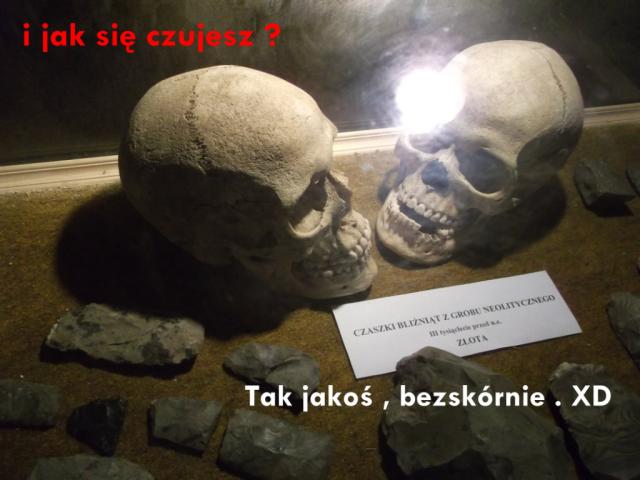 Czachy . ;d 