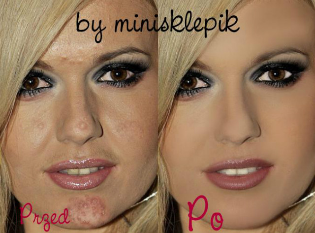 Wpis minisklepik