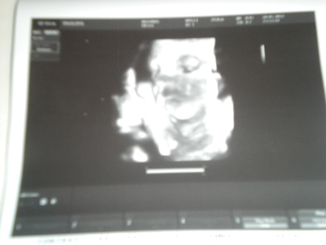 It's a Girl;)) 