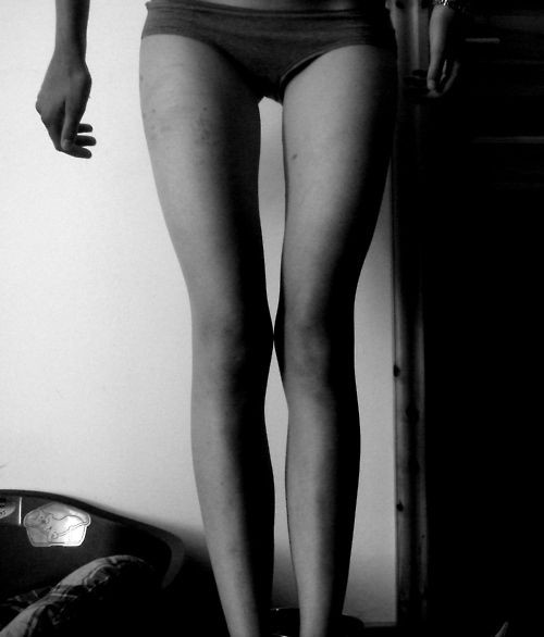 1.
