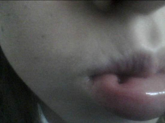 Za krtki labret