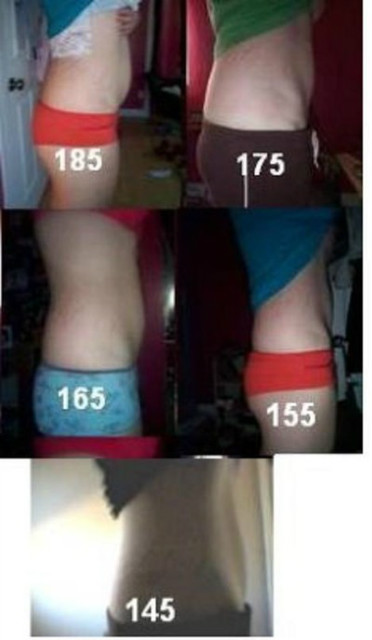 After&Before. 