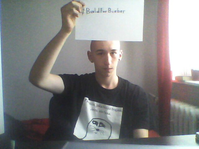 #BaldForBieber