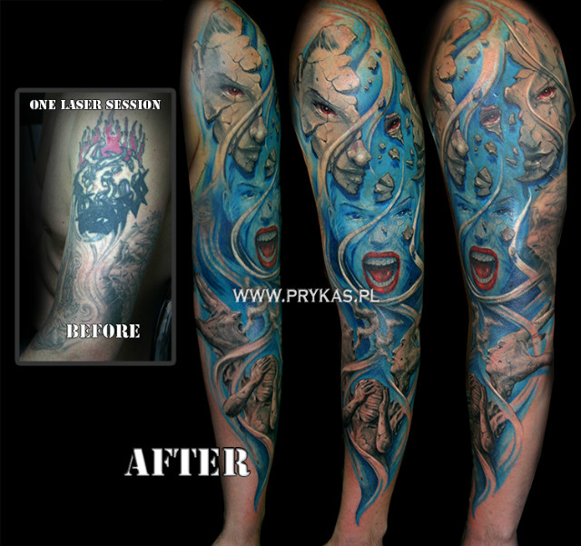 cover up prykas zdjcia