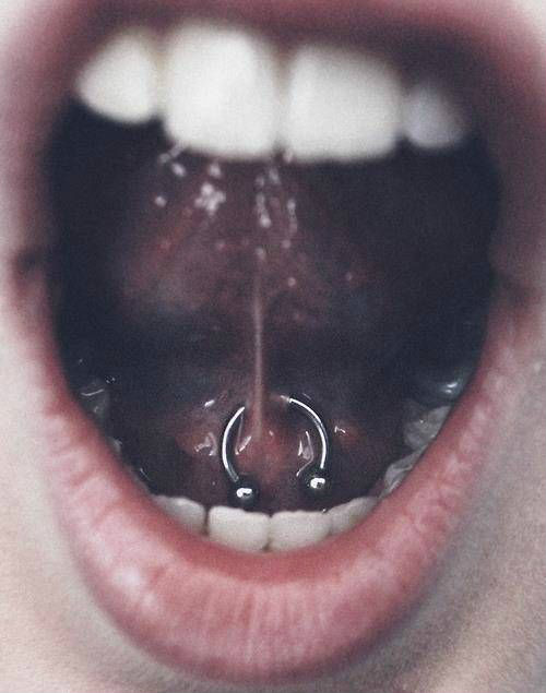 :P