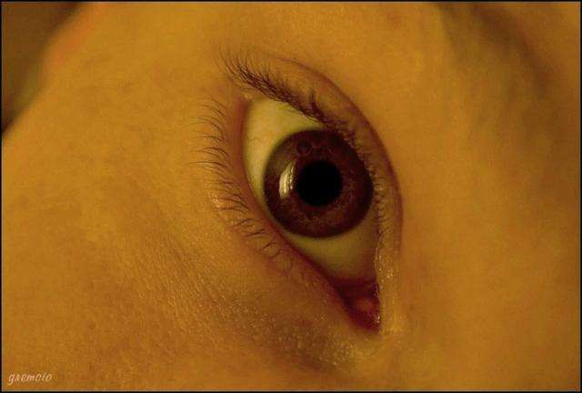 eye.