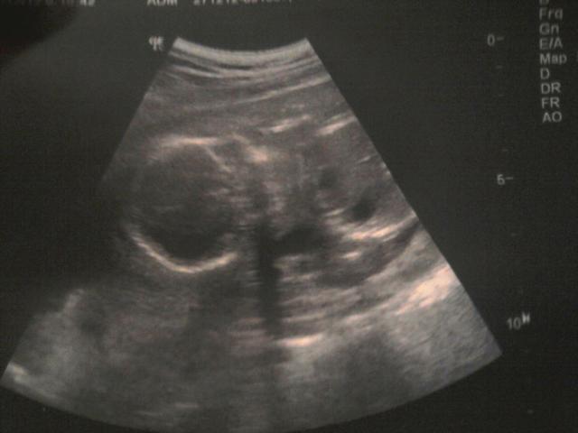 Wpis immortalkittyx3