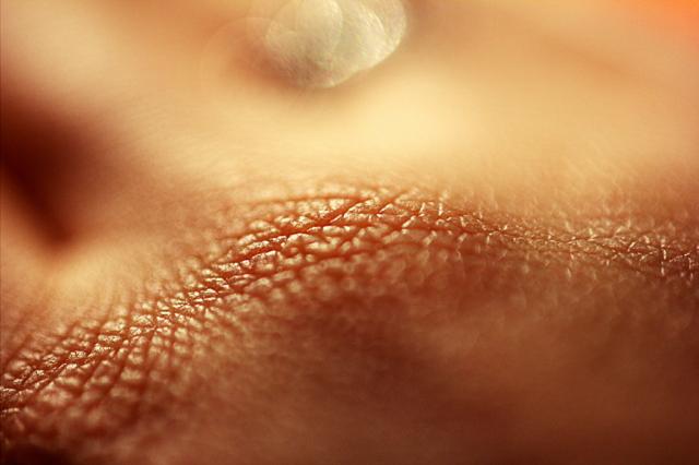 skin