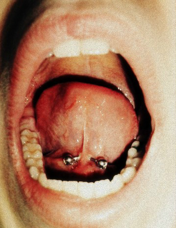 jest i tongue web! ;)