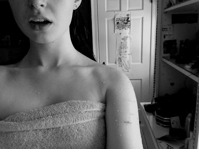scars on my arms