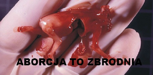 ABORCJA TO ZBRODNIA