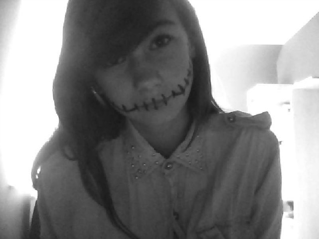 amnesia.
