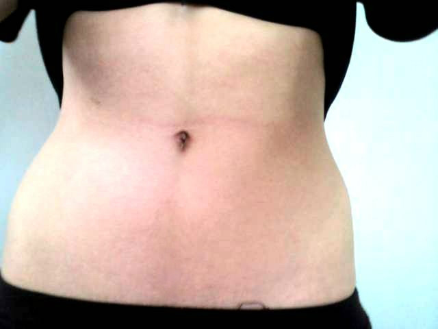 Wpis iwilltobeskinny