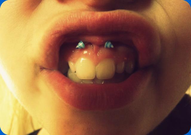 19. Smiley