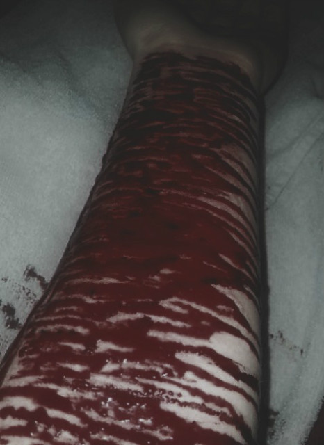 Wpis hidemysuffering