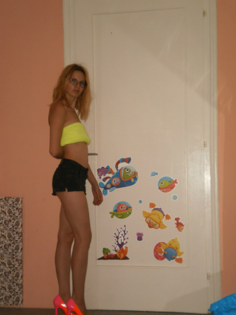 Opalenizna
