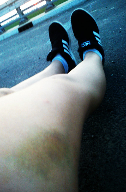 wybacz :c