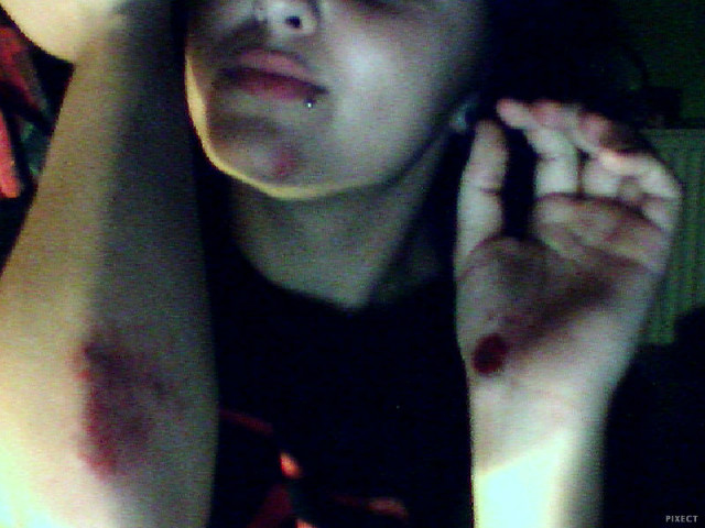 Wpis ledemurecorpse