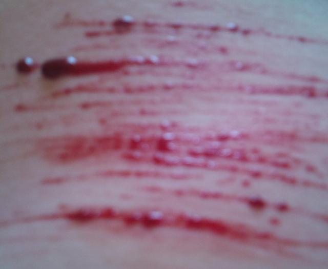 Wpis asocialslut