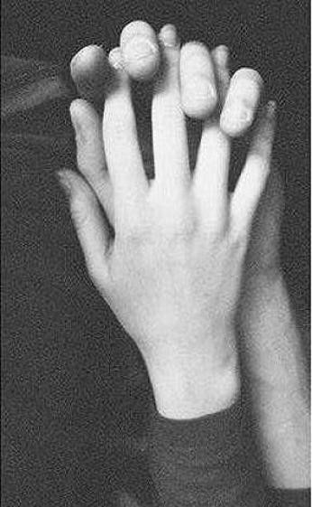 Wpis inf4ntile